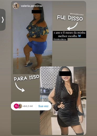 antesxdepois2
