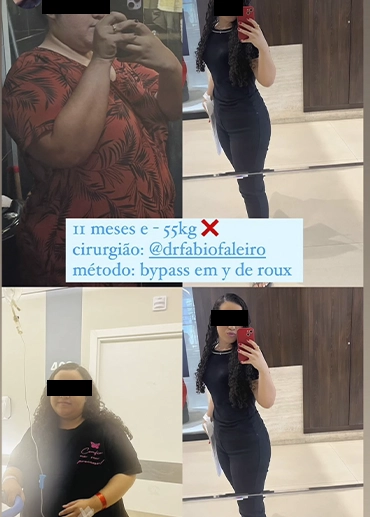 antesxdepois9