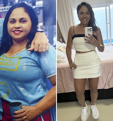 antesxdepois-dr-fabio-faleiro-3
