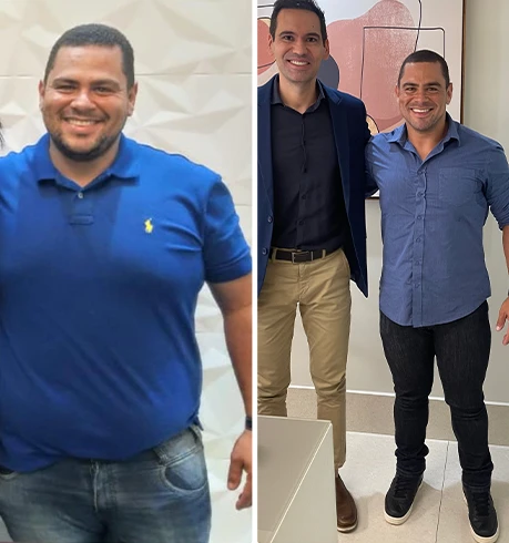 antesxdepois-dr-fabio-faleiro-5