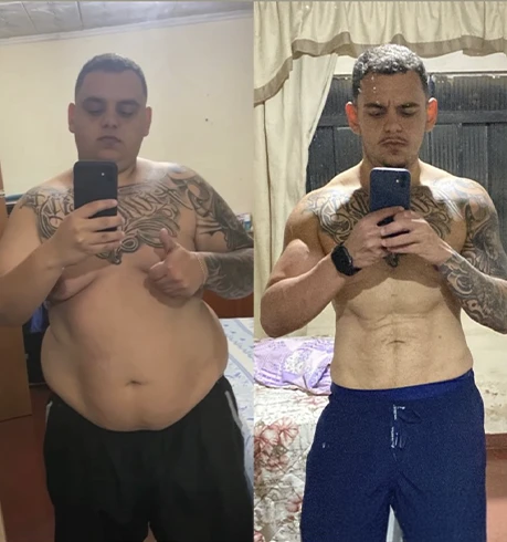 antesxdepois-dr-fabio-faleiro-6