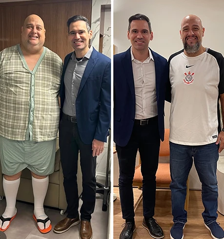 Resultado antes e depois de cirurgia bariátrica robótica - paciente do Dr. Fábio Faleiro