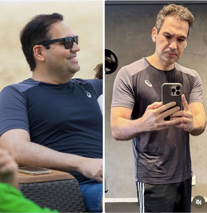 Antes e depois de paciente do Dr. Fábio Faleiro