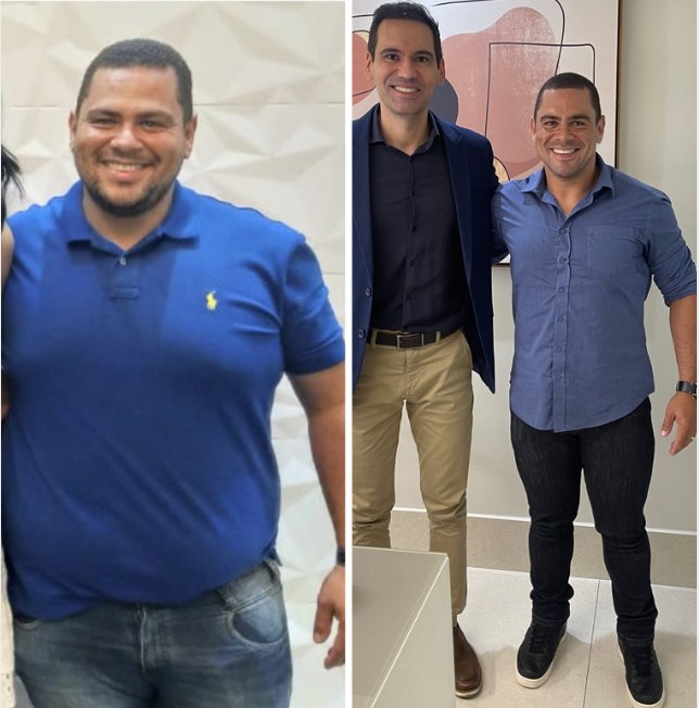 Antes e depois de paciente do Dr. Fábio Faleiro