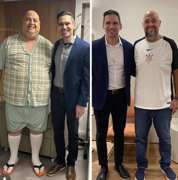 Antes e depois de paciente do Dr. Fábio Faleiro